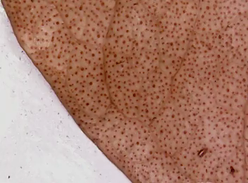 Muestra 1 del microscopio de LabsLand: hoja con manchas rojizas.