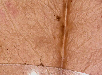 Muestra 5 del microscopio de LabsLand: detalle de la hoja envejecida.